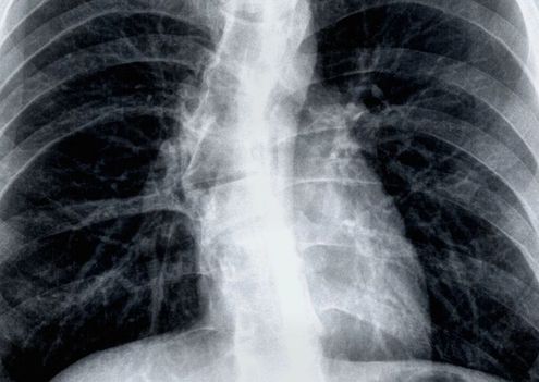 image-89aa72715dfb3f222f93aafedebcb329fc2d5c5e-1600x900-jpg